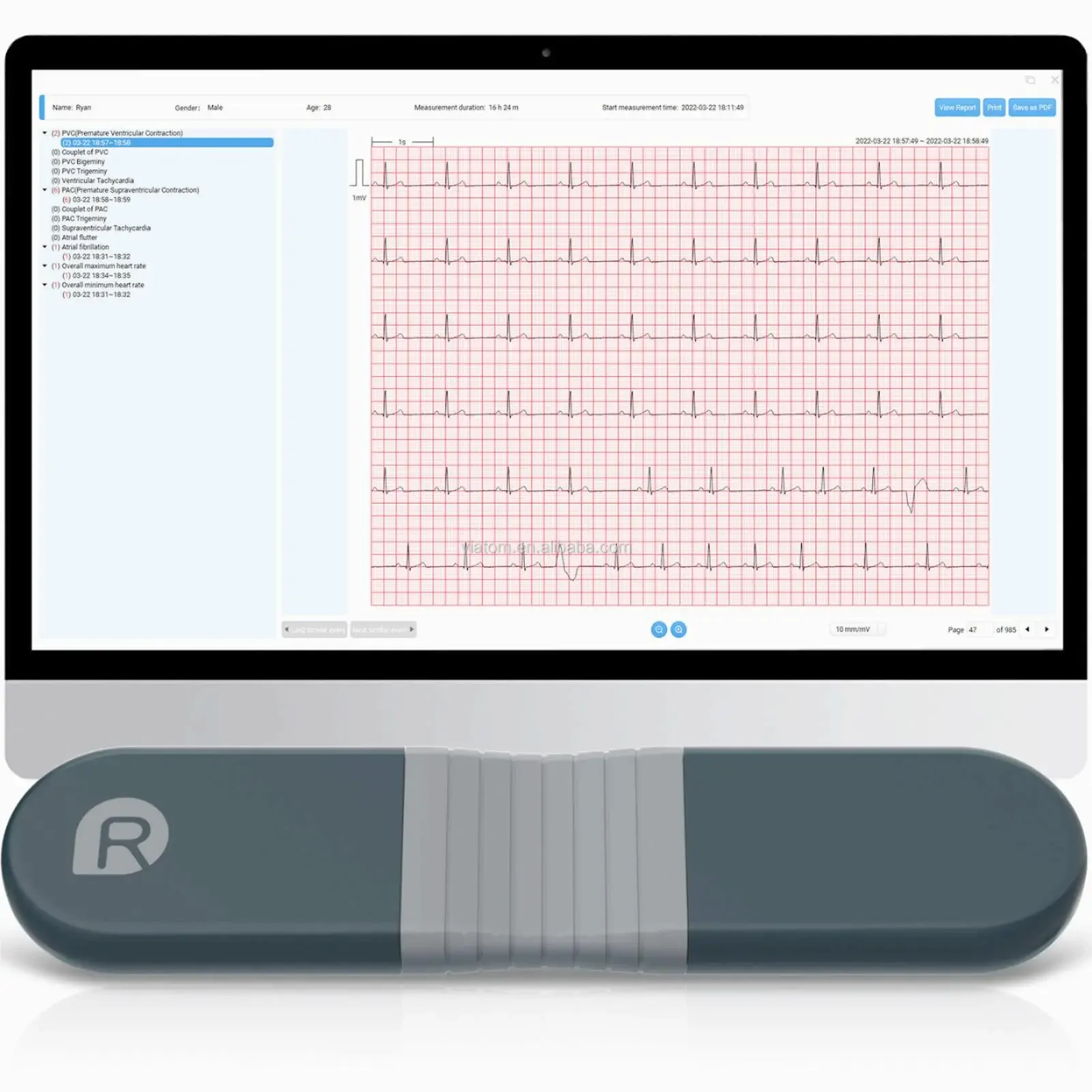 Wireless Bluetooth Dynamic Rec - Ecg Patch Monitor ulasan dan harga